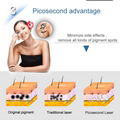 Honeycomb Lazer Energy Average Output Picosecond laser Tattoo Remove Picolaser