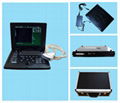 Laptop Ultrasound Scanner