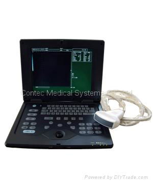 Laptop Ultrasound Scanner 2