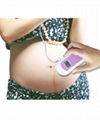 Pocket Fetal Doppler 3