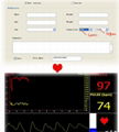 TFT Color Pulse Oximeter 3