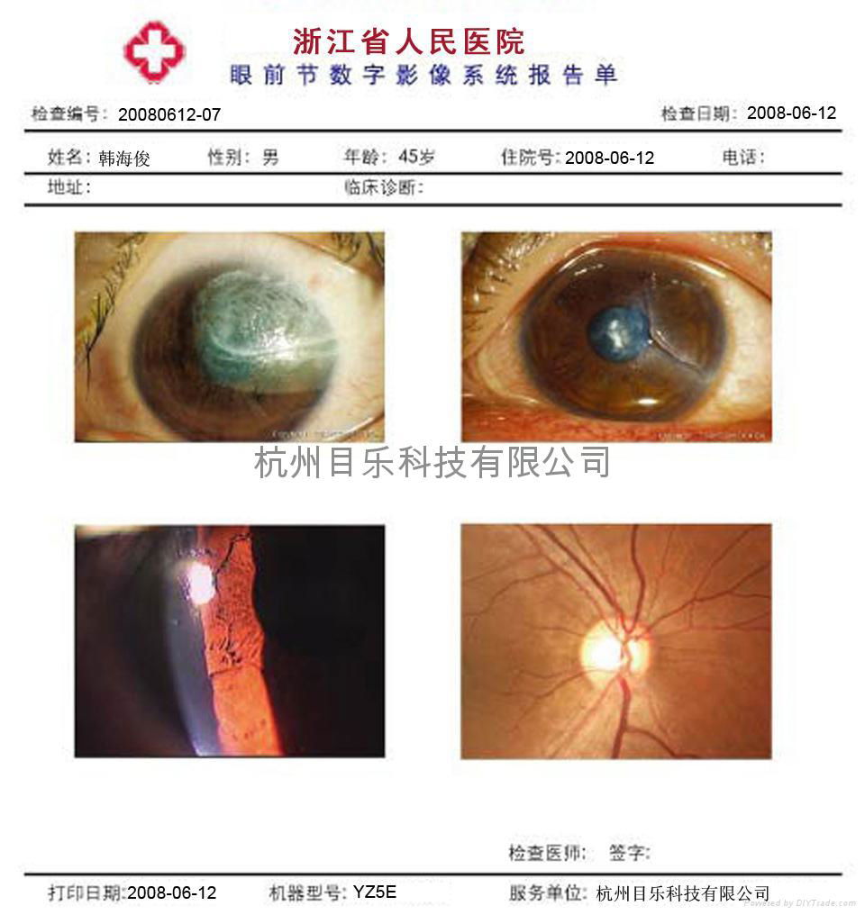 Slit Lamp Image Processing System 3