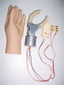 One degree of freedom,two way,myoelectric control prostheses(double electrode)